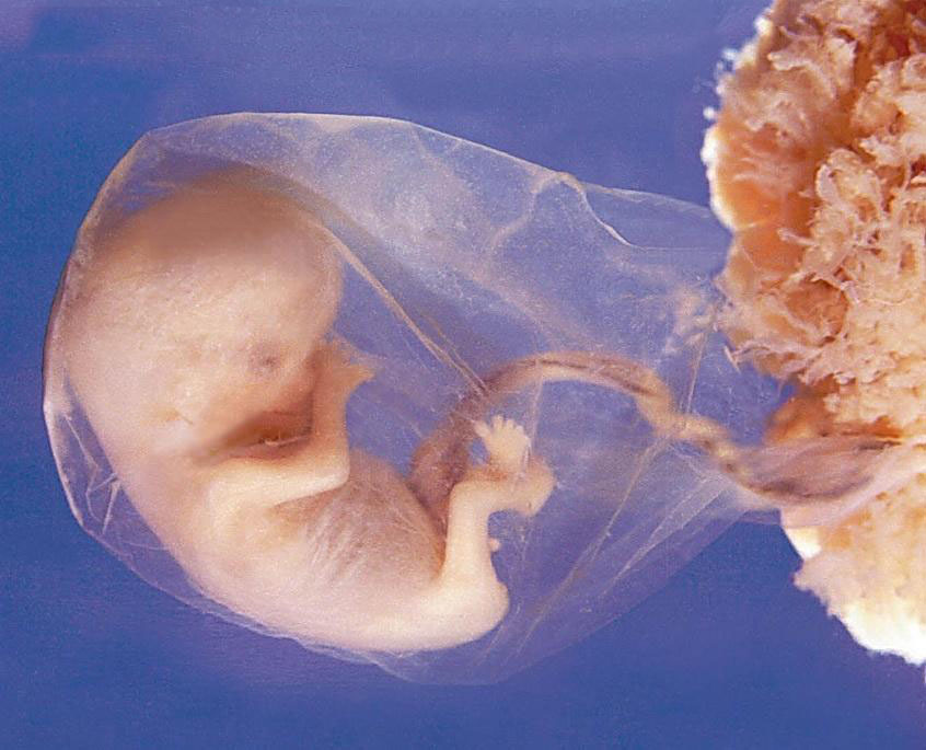 зародыш эмбрион человека